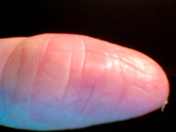 Haut pellt sich ständig an fingern und handflächen und heilt nicht+rote pun...