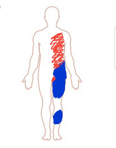 Haut Schmerzt Bei Beruhrung Was Ist Das Wohl Gesundheit Und Medizin Medizin Arzt Haut Schmerzt Bei Beruhrung Was Ist Das Wohl Gesundheit Und Medizin Medizin Arzt