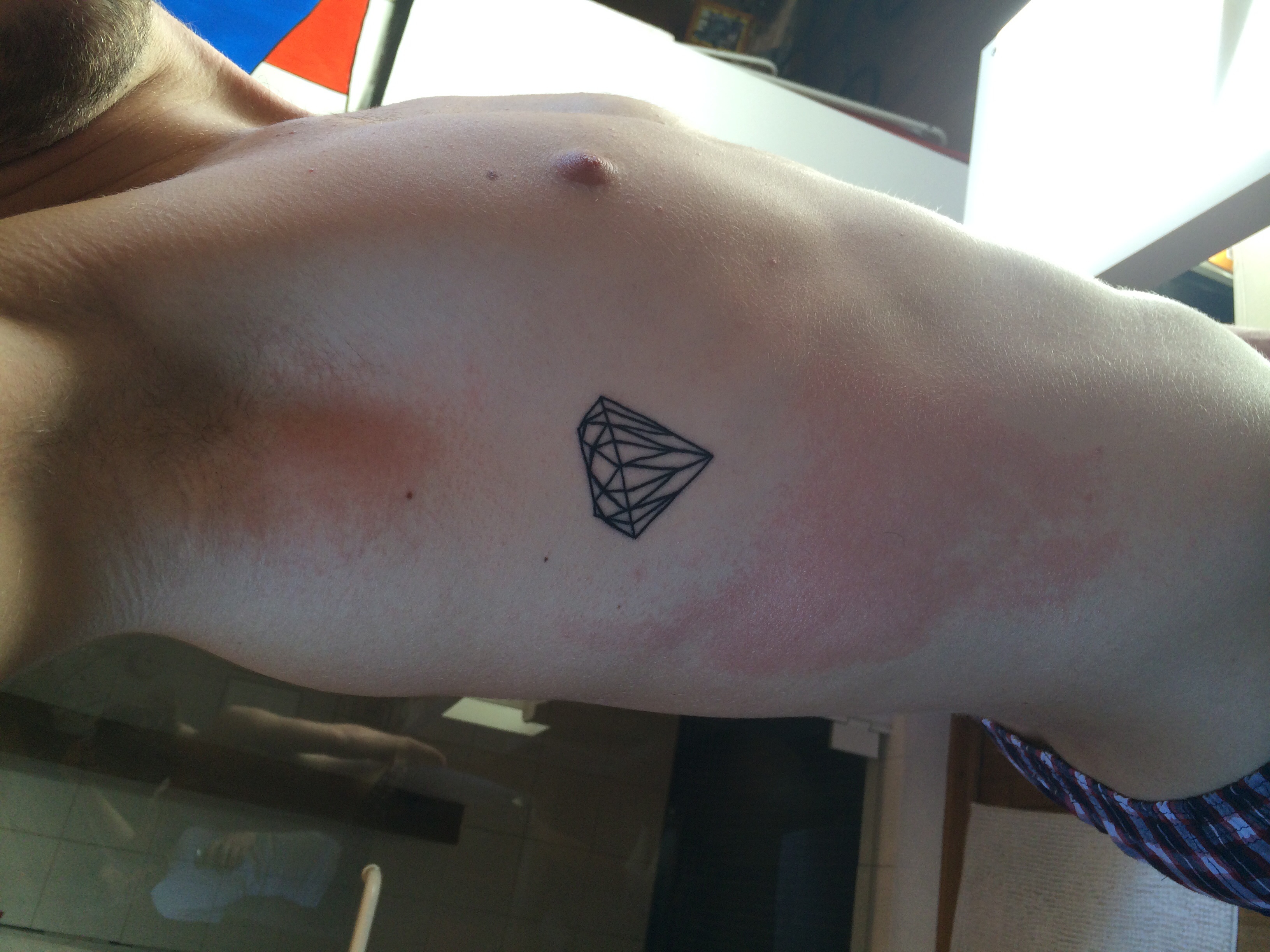 Hautasschlag unter meinem Tattoo (Gesundheit, Hautausschlag, rotehaut)