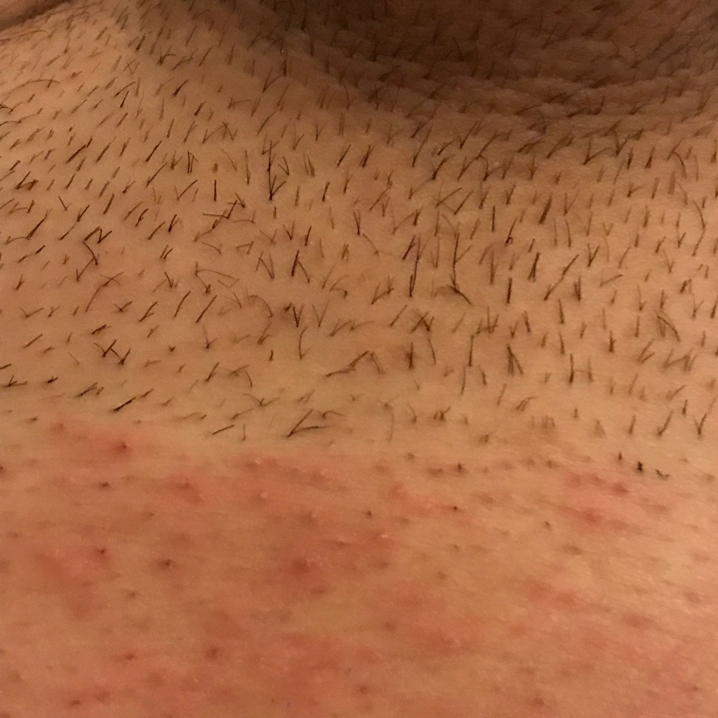 Intimrasur 2019 Trend Intimrasur 2019 Trend