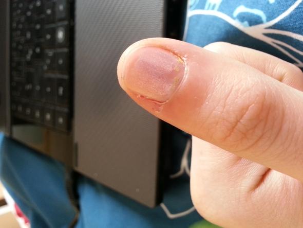 Fingernagel - (Pflege, Nägel, Hand)