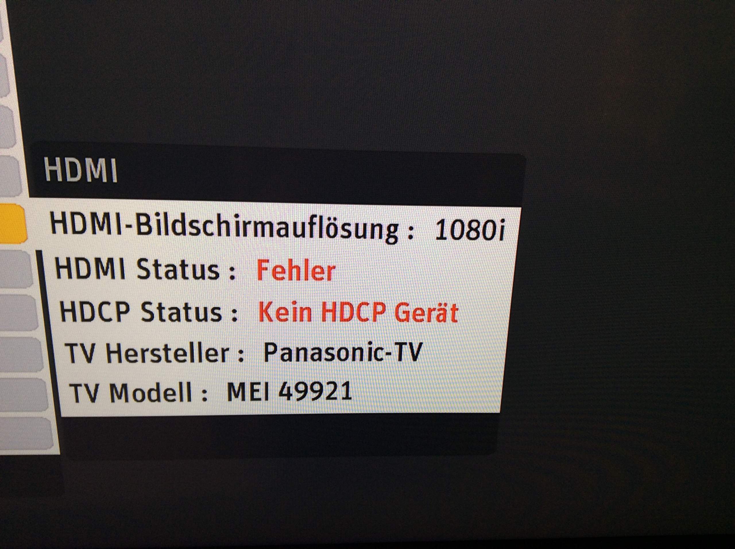 Der Fernseher Unterstützt Den Hdcp Kopierschutz Nicht