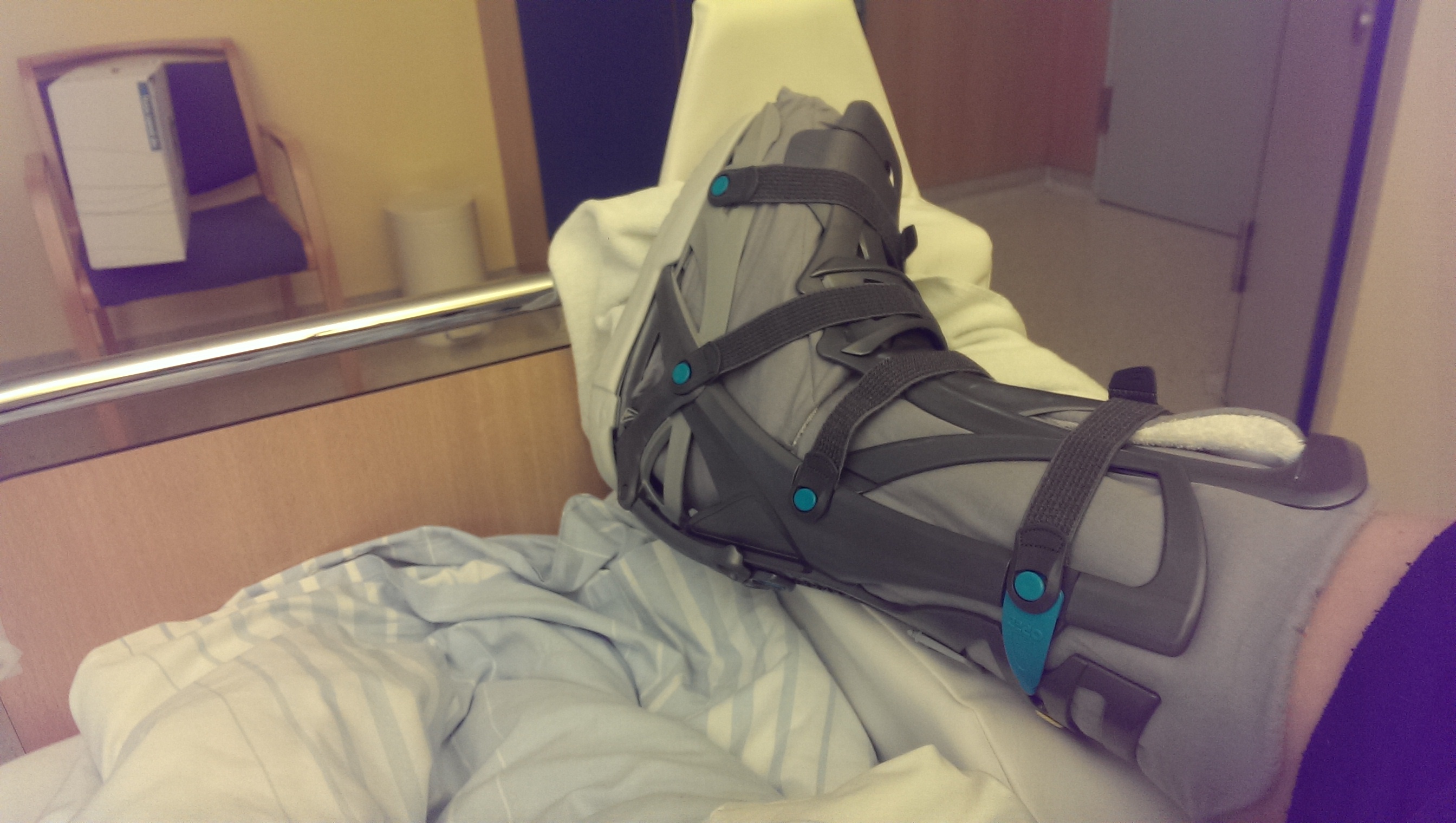 Heilung nach Bänderrissoperation Vacopedschuh (Operation, Sprunggelenk, Bänderriss) Heilung nach Bänderrissoperation Vacopedschuh (Operation, Sprunggelenk, Bänderriss)