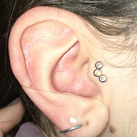Anderes Ohr im Vergleich  - (Gesundheit und Medizin, Piercing, Ohr)