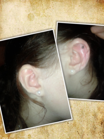 Links ist mein normales- und rechts mein Entzündetes Ohr - (Beauty, Piercing, Helix)