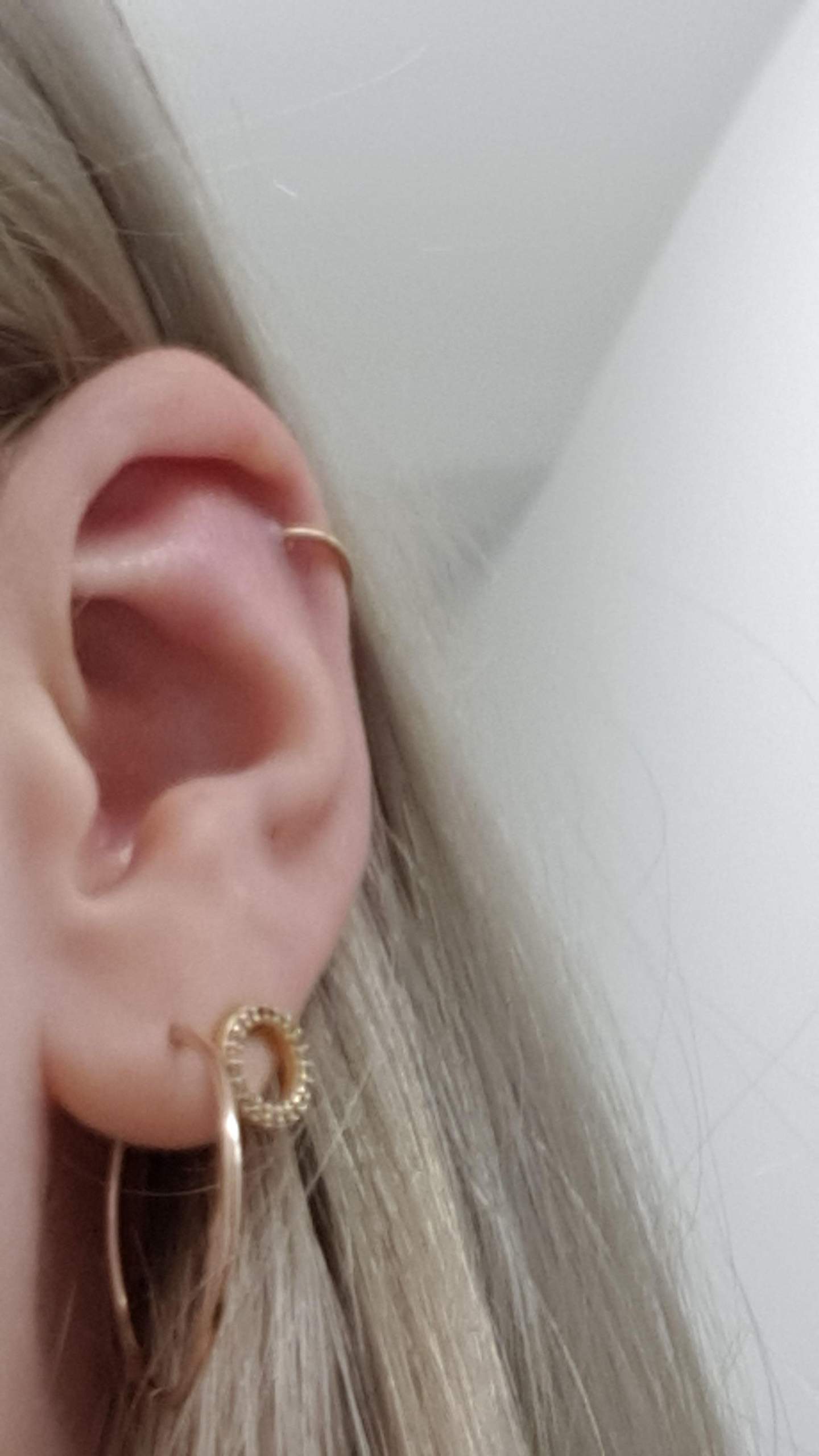 Helix ist das normal oder entzündet? (Entzündung, helix piercing, Conch Piercing)