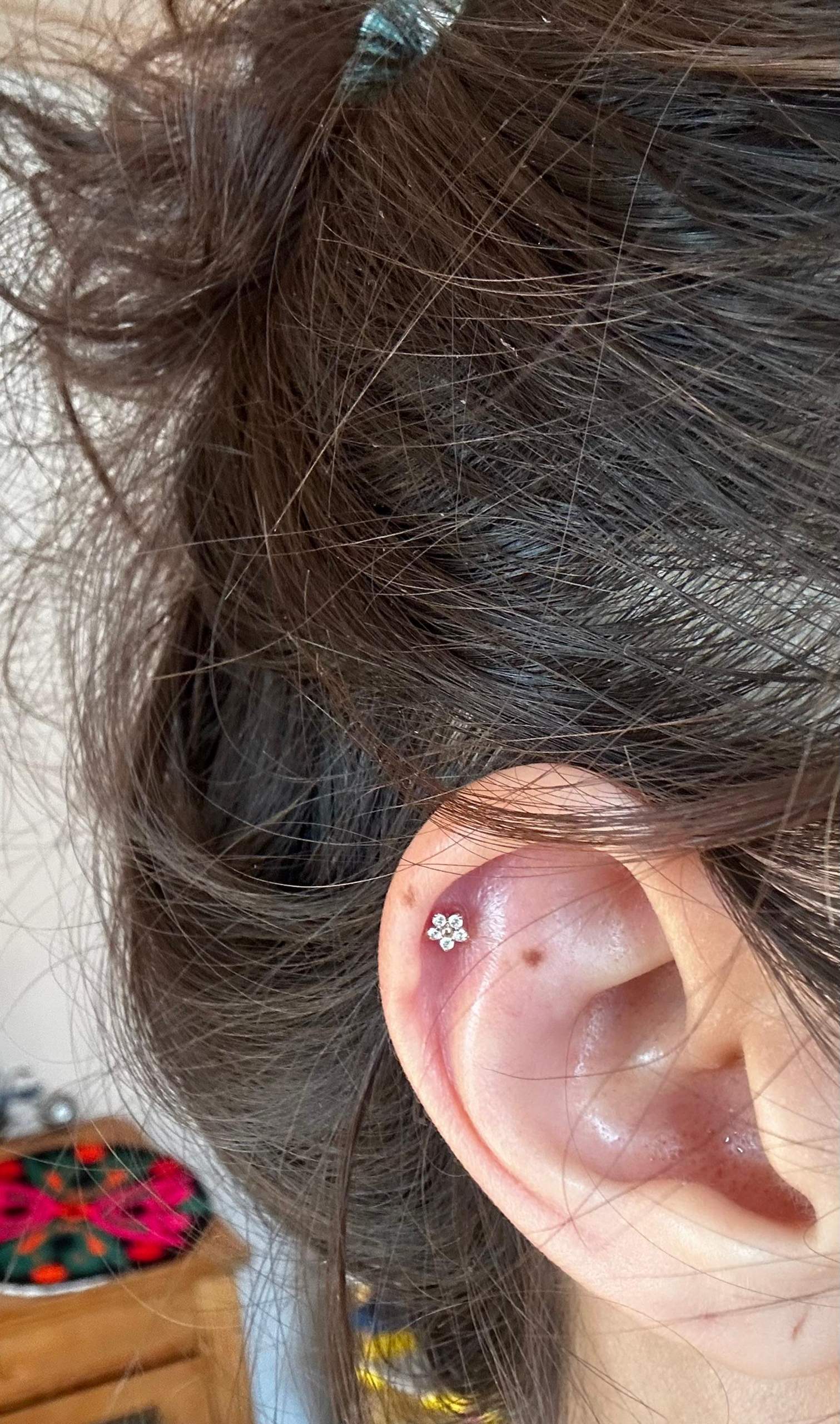 Helix Piercing entzündet Eiterblase oder Wildfleisch? (Entzündung, Ohr, Piercingpflege)