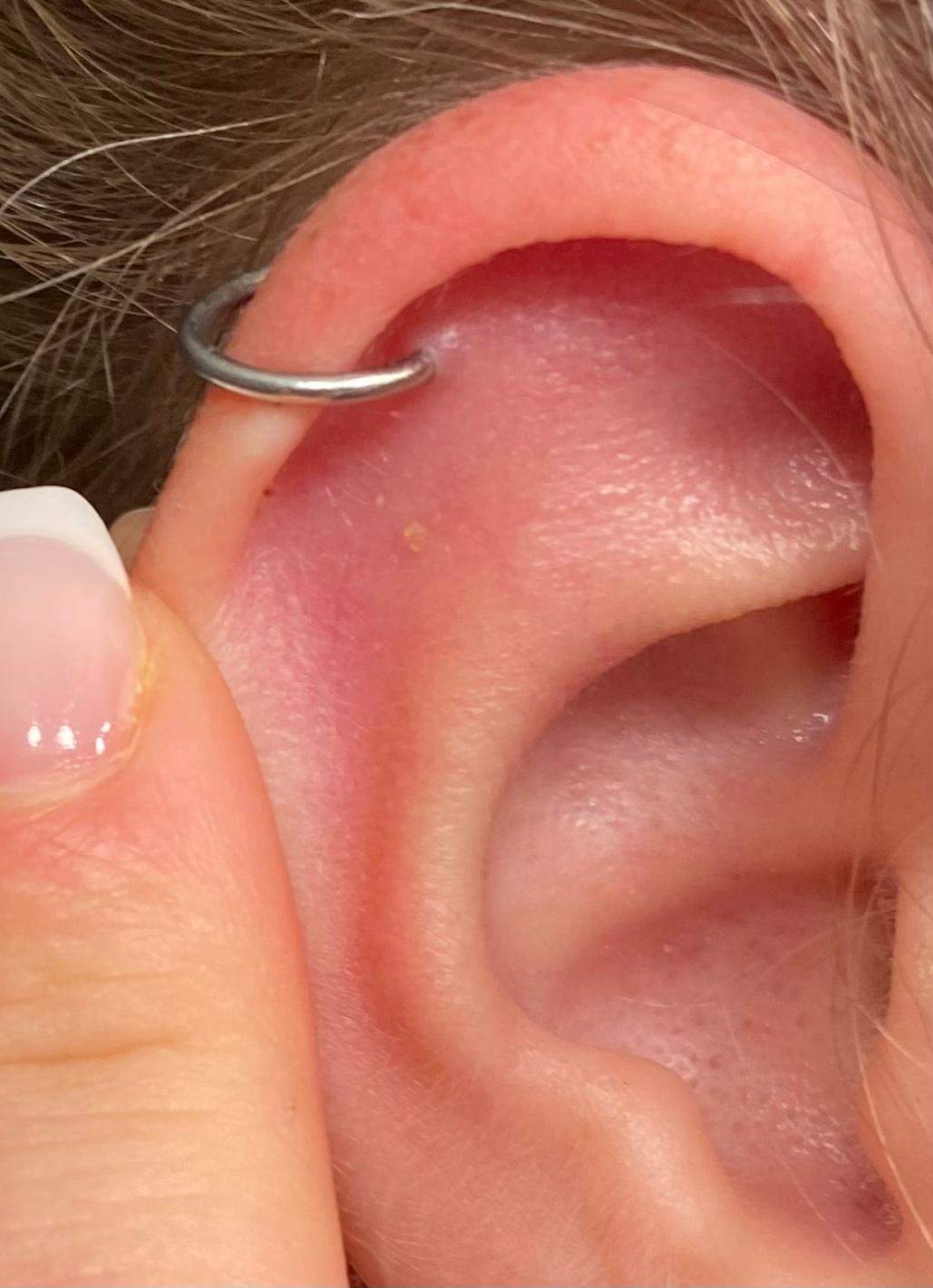 Helix Piercing entzündet nach dem Wechseln?