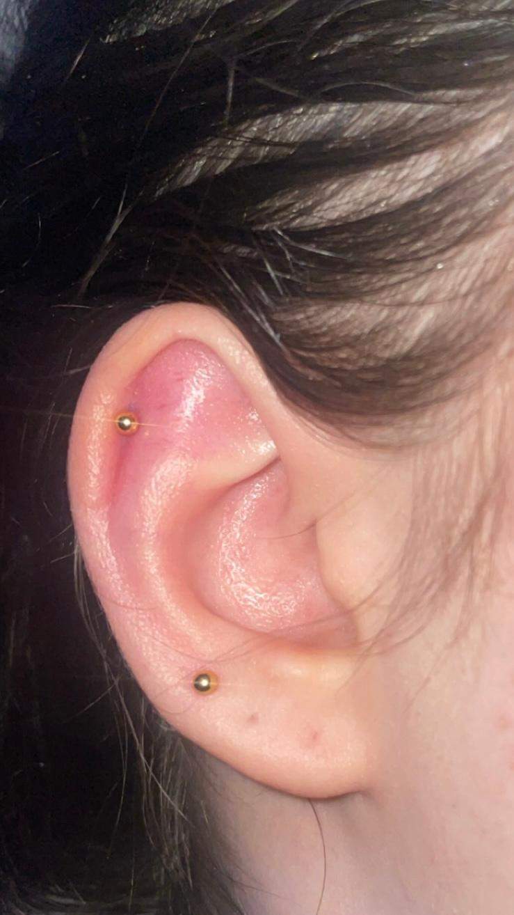 Tut Ein Helix Stechen Weh Helix Piercing entzündet oder nicht?habe es mir vor ca.6 tagen stechen