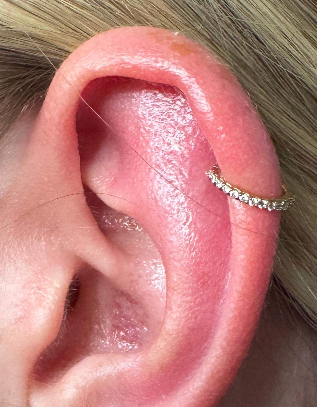 Helix Piercing entzündet (pocht, rot, dick)? (Entzündung, Ohr)