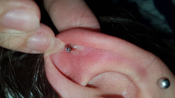 Was hilft piercing entzündet helix Piercing entzündet