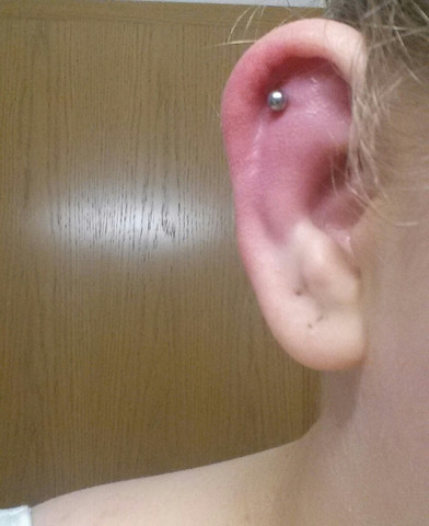 Nachher - (Gesundheit, Piercing, Helix)