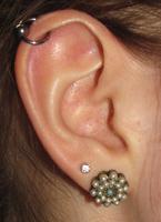 helix-Piercing - (Ohr, Ohrloch, helix piercing)