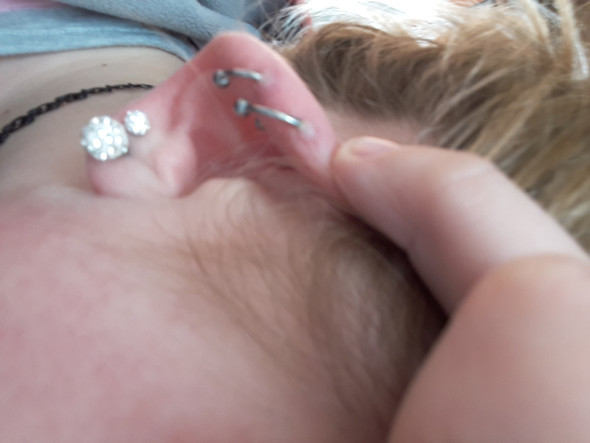 Helix Piercing Blaschen