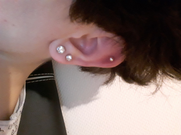 Helix Selber Gestochen Entzundung