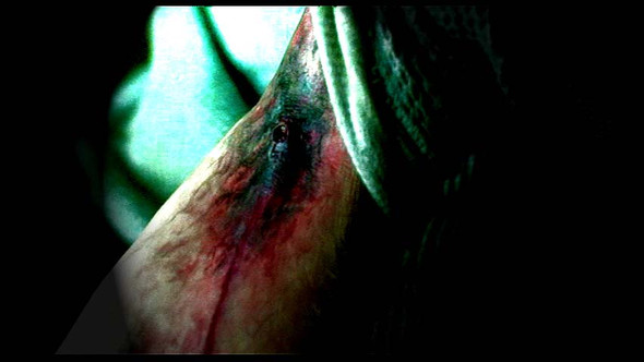 Heroin-Arm - (Drogen, Heroin)