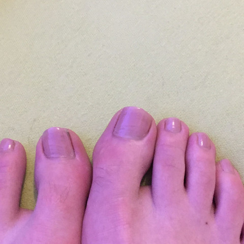 Hey Findet Ihr Es Schlimm Wenn Jungs So Einen Nagellack Tragen Und Welche Farbe Ware Noch Gut Madchen Fusse