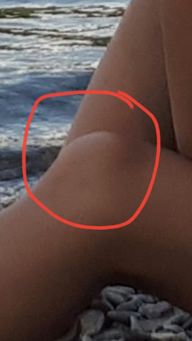 Knie - (Gesundheit, Körper, schiefes Knie)