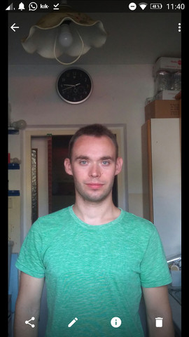 Hi Leute Wie Sehr Storen Meine Abstehenden Ohren Aussehen