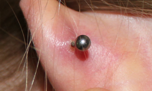 helix von hinten - (Piercing, Helix)