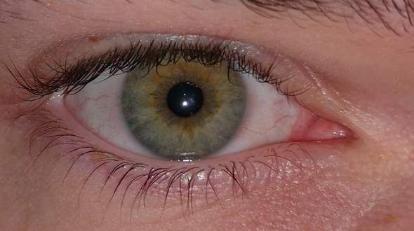 - (Augen, Farbe, Licht)