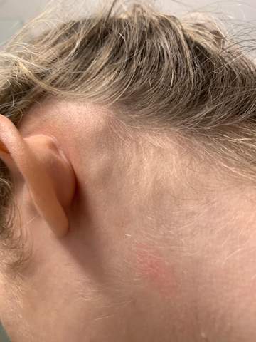 Hilfe Beule Gesundheit Angst Ohr Hilfe Beule Gesundheit Angst Ohr
