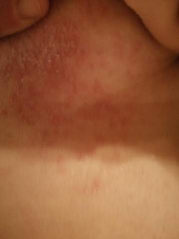 Hilfe Bitte Schnell Was Kann Das Unter Meiner Brust Sein Gesundheit Und Medizin Gesundheit Medizin Hilfe Bitte Schnell Was Kann Das Unter Meiner Brust Sein Gesundheit Und Medizin Gesundheit Medizin