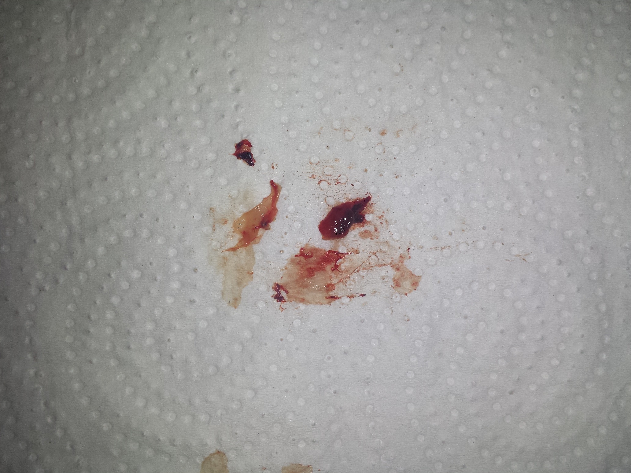 HIlfe Blutklumpen aufgestoßen? Panik! (Gesundheit, Blut ...