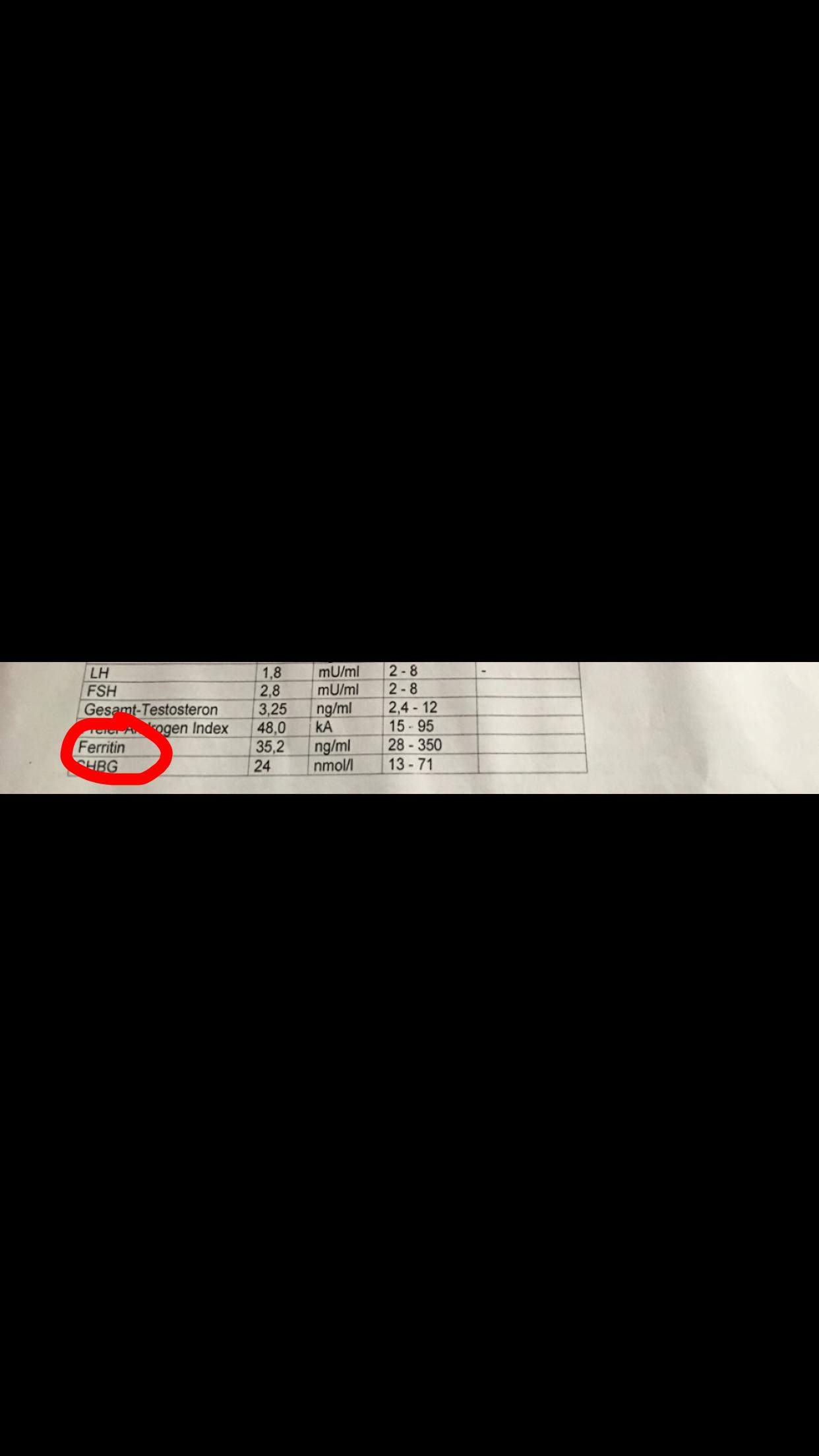 Hilfe Ferritin Wert Zu Niedrig Ursache Fur Meinen Haarausfall Gesundheit Und Medizin Hilfe Ferritin Wert Zu Niedrig Ursache Fur Meinen Haarausfall Gesundheit Und Medizin