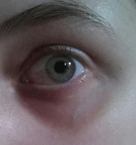 Mein Auge. - (Aussehen, Gesicht, Kosmetik)