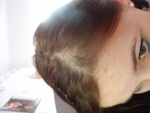 Hilfe Haarausfall Mit 13 Weiss Nicht Was Ich Noch Machen Soll Haare Beauty Haarpflege