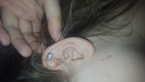 Hilfe Habe Gestern Helix Piercing Beim Juwelier Stechen Lassen Kann Mir Jemand Helfen Schmerzen