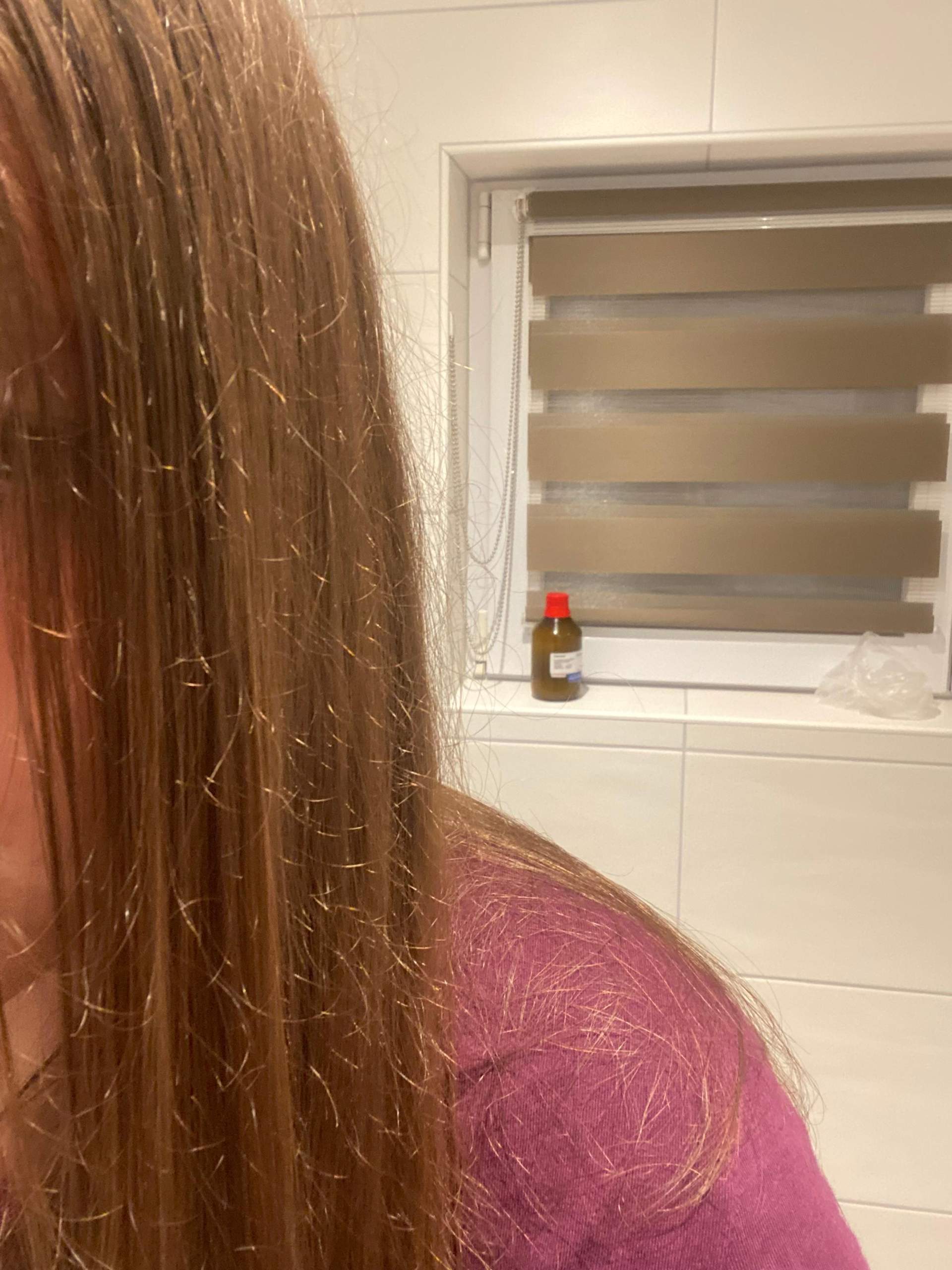 Kahle Stellen Haare Nach Extensions Kaputt Hilfe! Meine Haare sind komplett kaputt, was kann ich tun? (Haarpflege