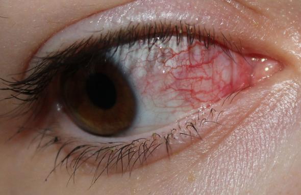 Mein Auge.. - (Augen, rot)