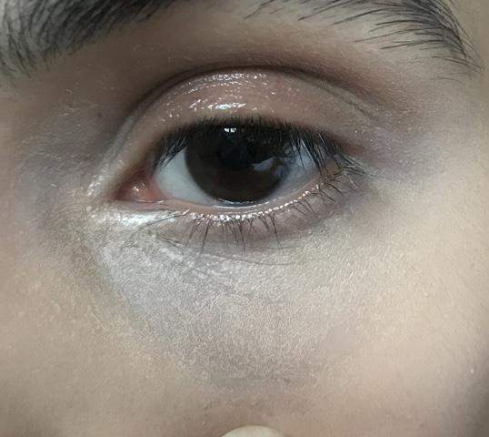 Hilfe Sehr Trockene Augen Concealer Problem Gesundheit Und Medizin Gesundheit Beauty