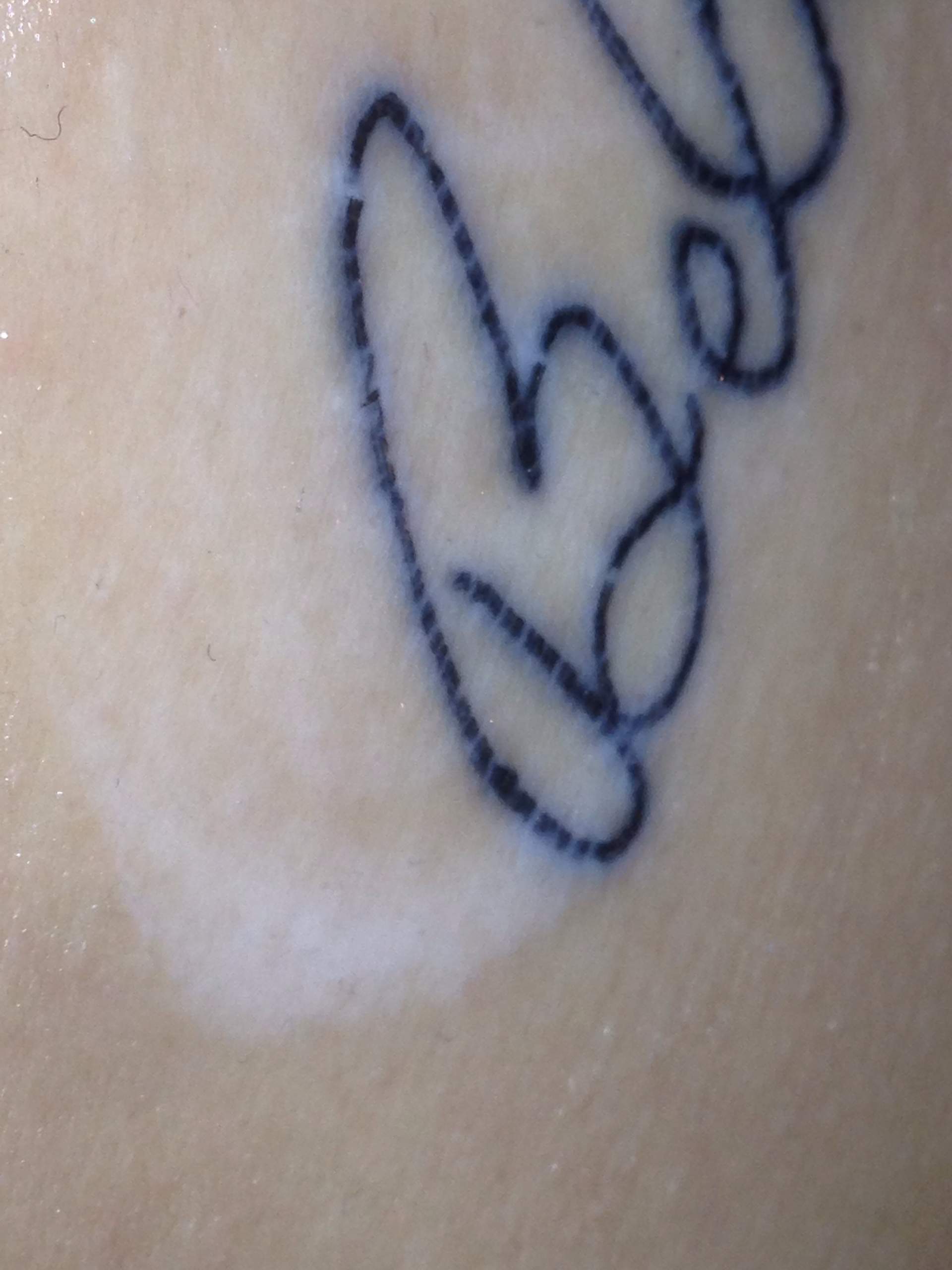 Hilfe! Wächst mein tattoo raus!? Oder ist das normal? (Tätowierung)