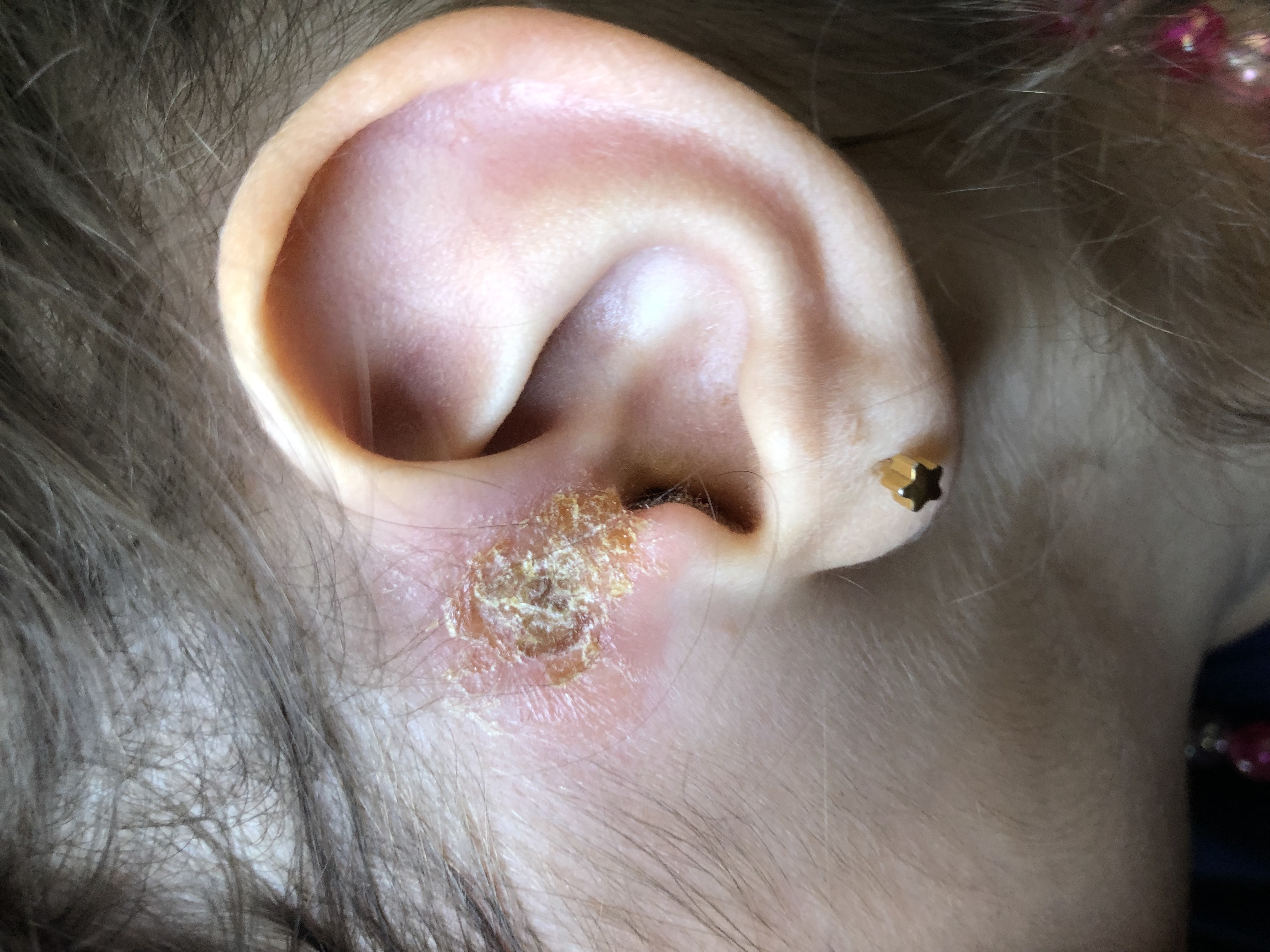 Archäologie Unangenehm Beitrag eiter im ohr was tun Äquator Prime Jedes Jahr Archäologie Unangenehm Beitrag eiter im ohr was tun Äquator Prime Jedes Jahr