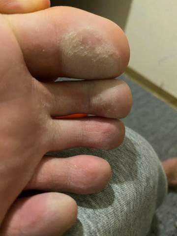 Hilfe was ist das an mein Fuß?