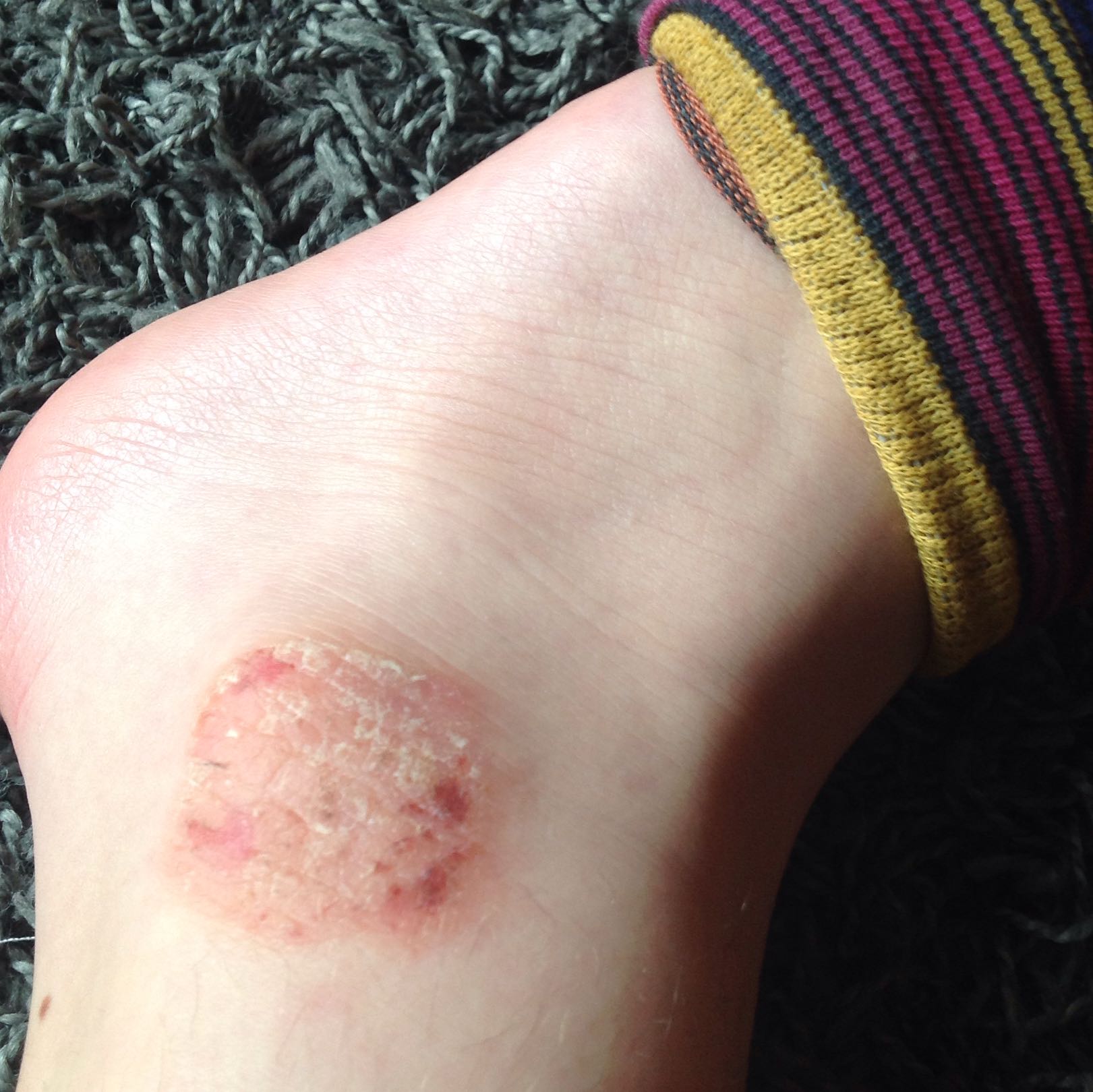 Hilfe was ist das denn an