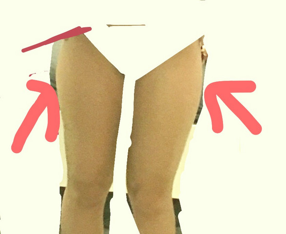 Hilfe Was Kann Ich Gegen Reiterhosen Machen Gesundheit Sport Frauen
