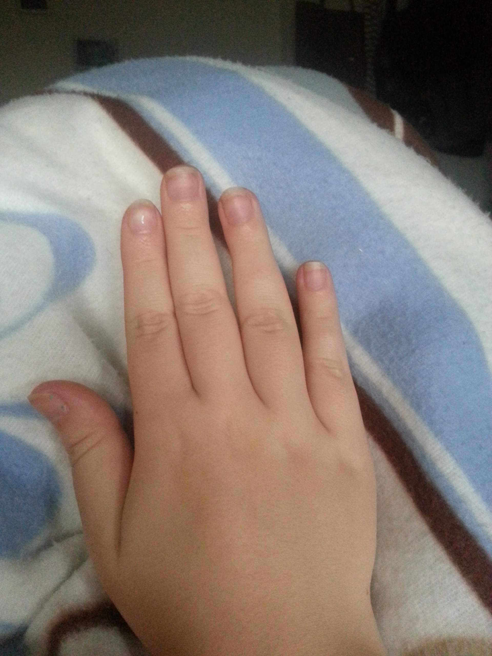 hilfe was tun gegen dicke wurstfinger? (Körper, Diät)