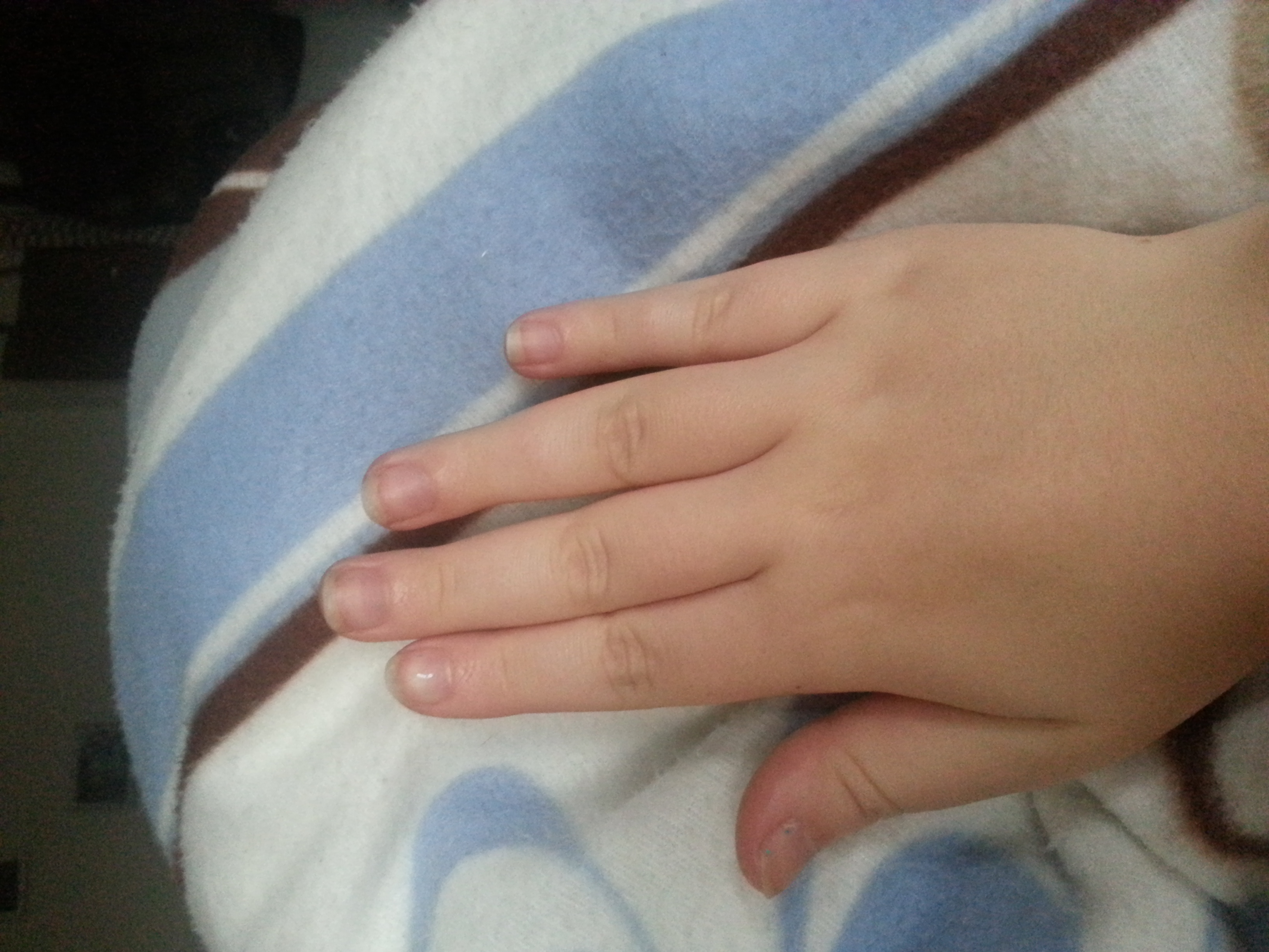 hilfe was tun gegen dicke wurstfinger? (Körper, Diät)