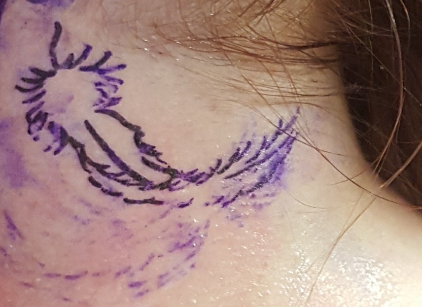 Hilfe, werden die Linien noch dünner? (Tattoo)