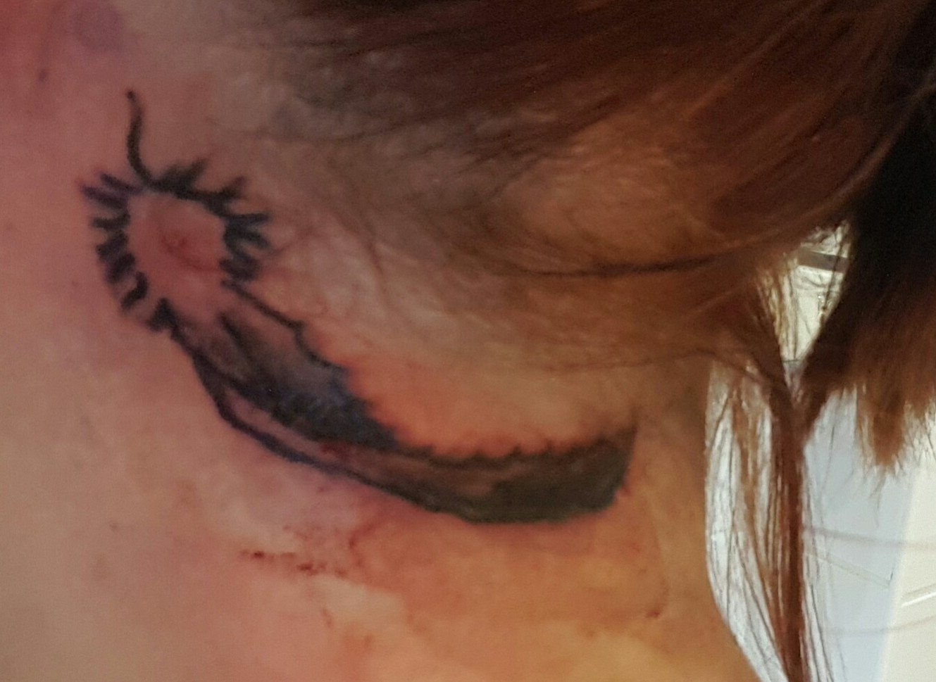 Wie Sieht Ein Entzündetes Tattoo Aus
