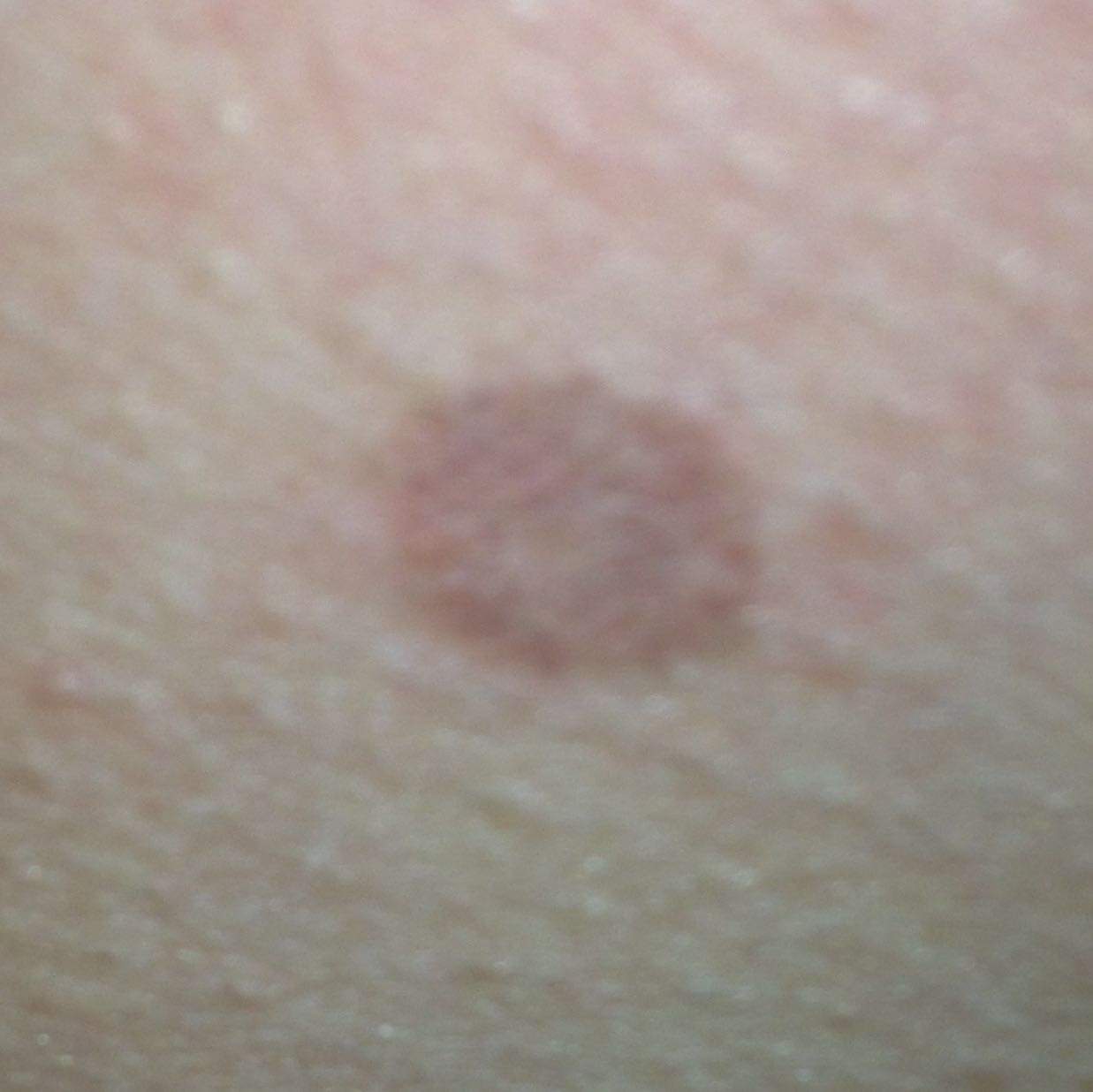 Hilfee was ist das für ein komischer Fleck unter der Brust? Hilfee was ist das für ein komischer Fleck unter der Brust?