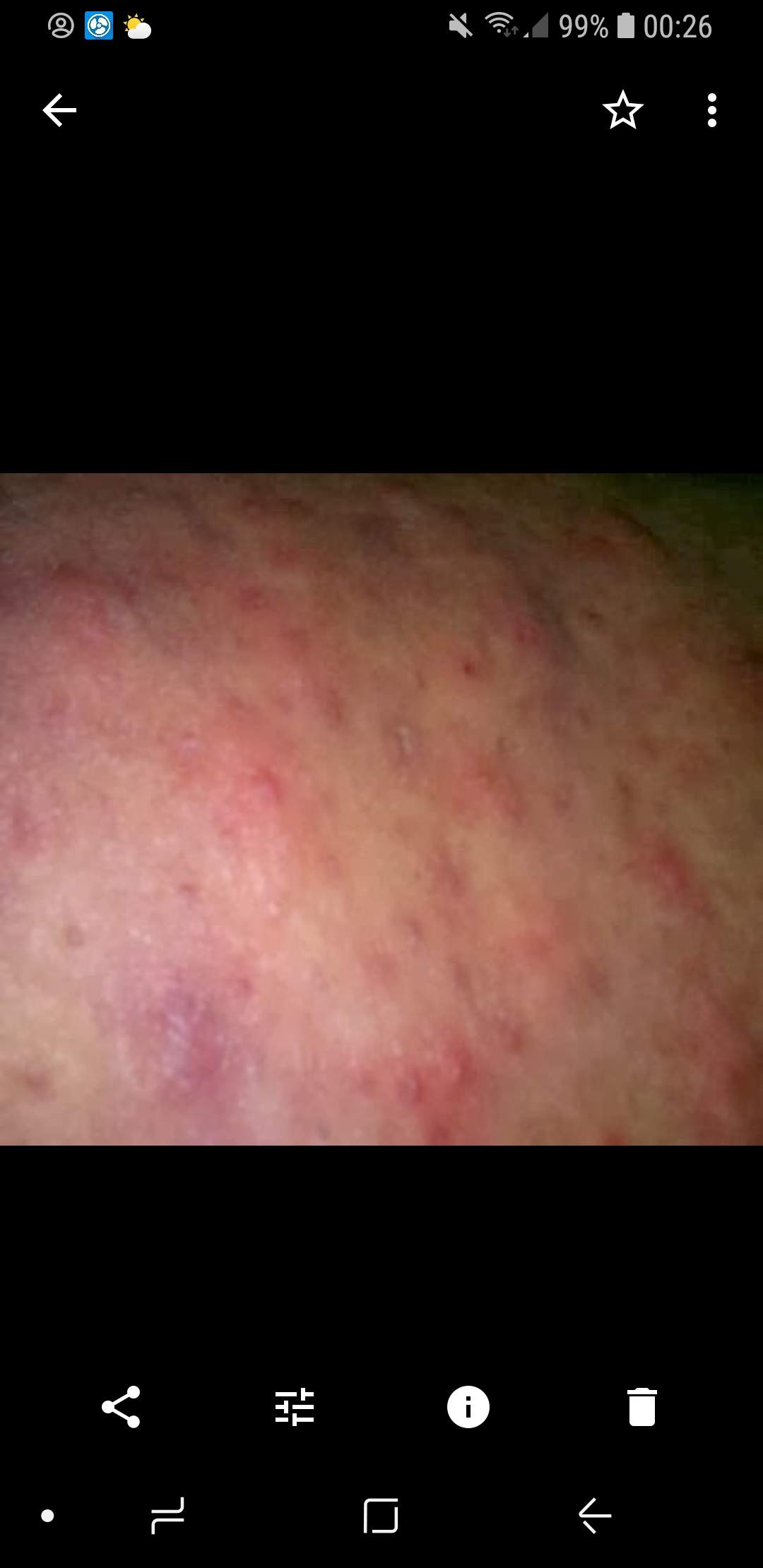 Hilfeee Was ist das denn nach der Rasur taucht es auf ? (Gesundheit, Haut, rasieren)