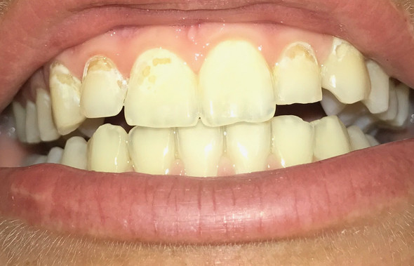 So sehen meine Zähne aus..  - (Zähne, Zahnarzt)