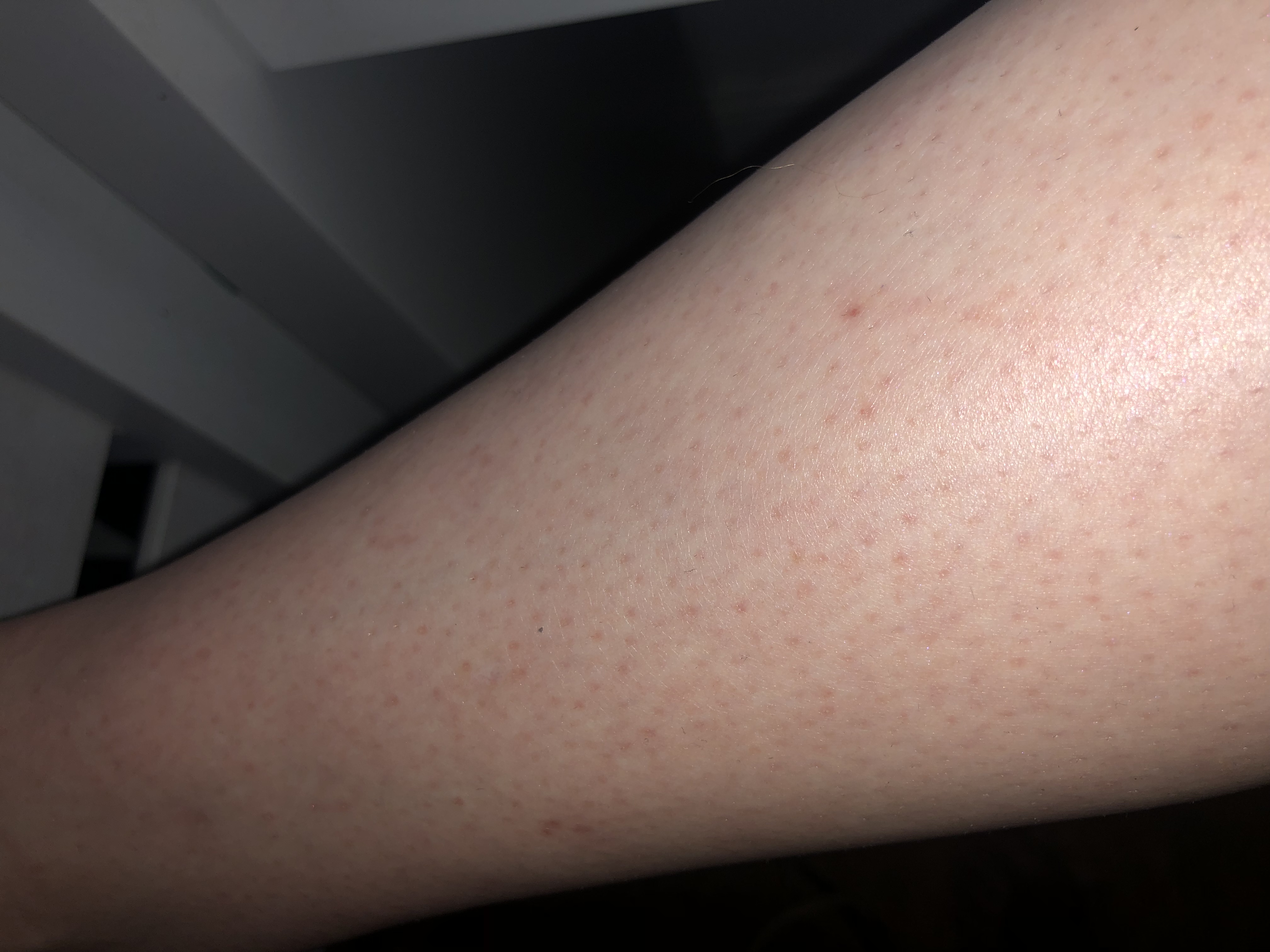 hilfe rote punkte an den beinen