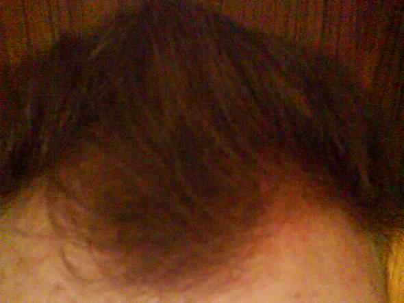 hilft zwiebelsaft bei starken