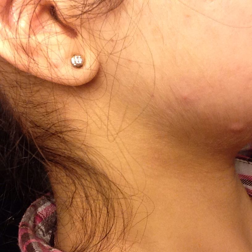 hillffeee haare im gesicht was tuen